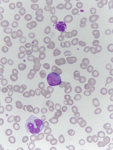 Leukocytes