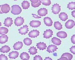 Crenated Cells