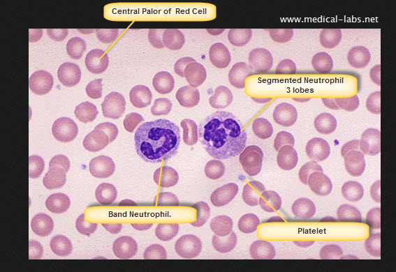 Normal red blood cell - peripheral blood smear