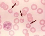 Bite Cell (Degmacyte)