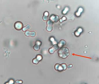 Calcium carbonate crystals