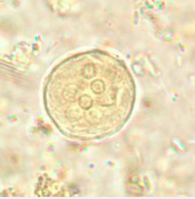 Cysts of Entamoeba coli