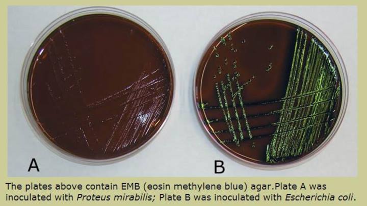 Eosin methylene blue agar (EMB) .