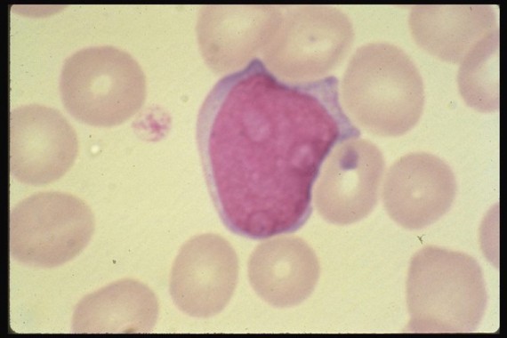 Myeloblast
