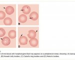 Red Blood Cell Morphologies