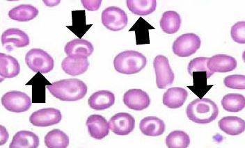 Several Target Cells (Codocytes)