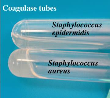 Staphylococcus - Coagulase test