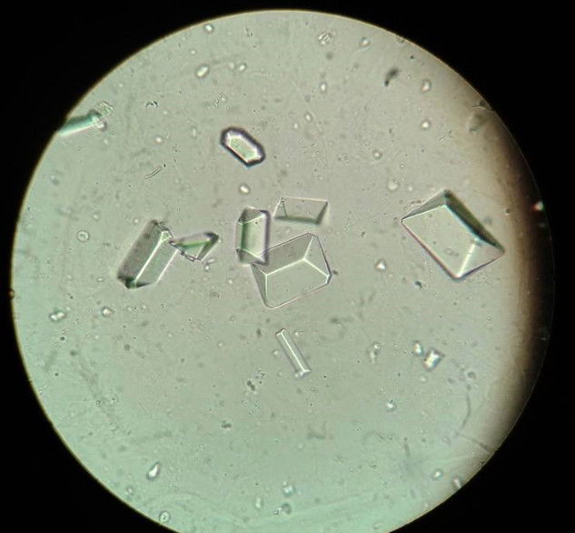 Triple Phophate Crystals