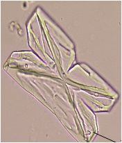 fern-leaf shape of Triple Phosphate crystals