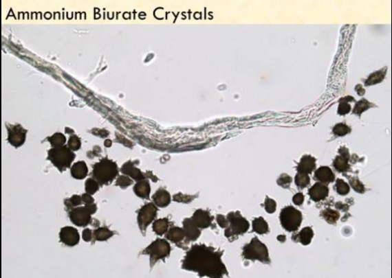 Ammonium Biurate Crystals
