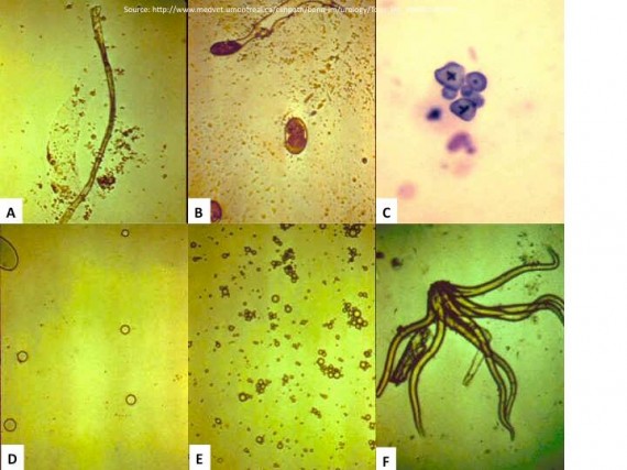 Few common Artifacts and elements in Urinalysis