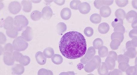 Myelocyte Morphology Medical Laboratories Myelocyte Morphology Medical Laboratories