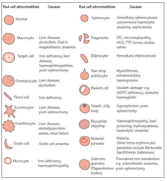 Red Cell Abnormalities Medical Laboratories