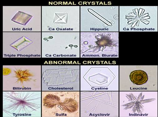 Urine Crystals Forms