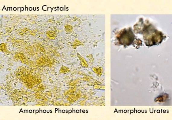 amorphous crystals