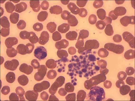 platelets aggregation