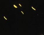 acid-fast bacilli by fluorescence microscopy