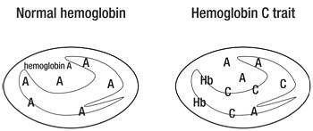 People with hemoglobin C do not have Hemoglobin C disease or sickle cell disease. They cannot develop these diseases later in life. They can pass hemoglobin C trait to their children.