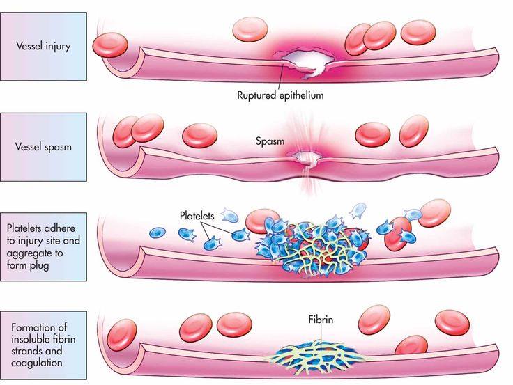 basic steps in hemoatasis Medical Laboratories