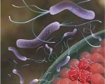 Helicobacter pylori