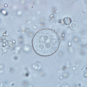 Cyst of Entamoeba coli in an unstained wet mount preparation with saline 