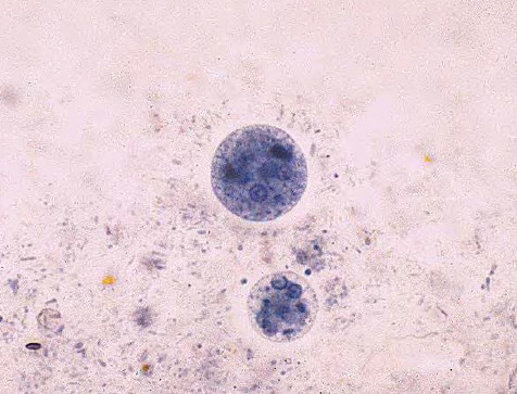 Entamoeba coli (larger) and Entamoeba histolytica (smaller) cysts