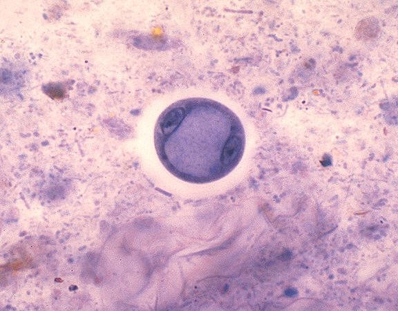 Entamoeba coli: iron hematoxylin stain with Two mononucleate cysts: the large, central glycogen vacuoles have compressed the nuclei to the margin of the cyst