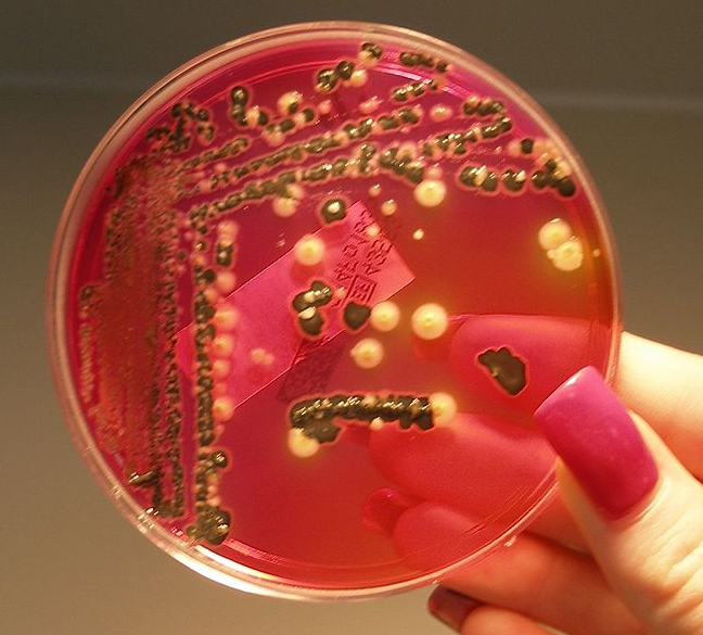 Salmonella bacteria growing on XLD agar