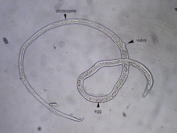Capillaria philippinensis adult female worm