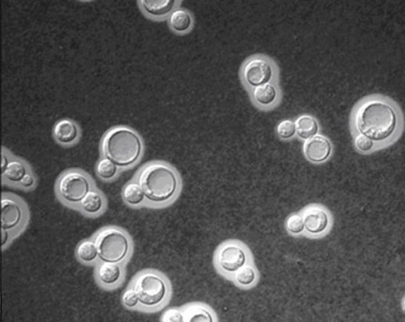 Cryptococcus neoformans yeast cells