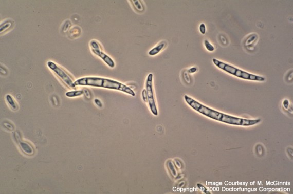 Fusarium oxysporum
