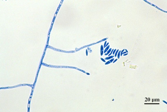 Fusarium spp sickle shape macroconidia