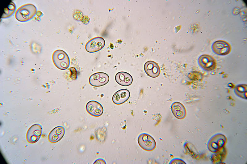 Isospora belli in wet mount stool smear Medical Laboratories