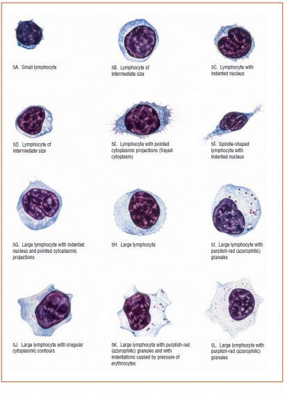 Large and Small lymphocytes