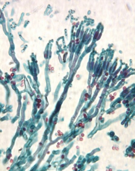 Molds - Filamentous fungi