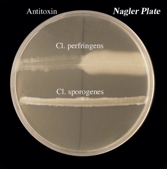 Nagler's reaction of Cl. perfringens