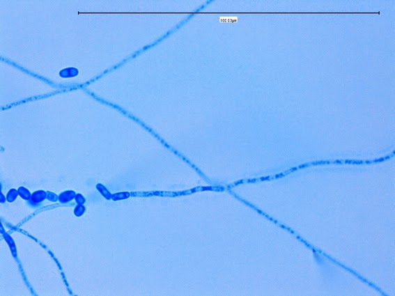 Trichosporon asahii -a hyphal element running from right to left through the center of the photo can be seen disarticulating (fragmenting) into barrel-shaped arthroconidia.
