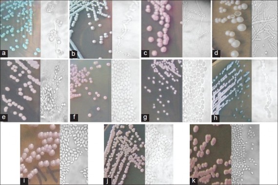 Yeasts identification on Cornmeal agar (CMA)