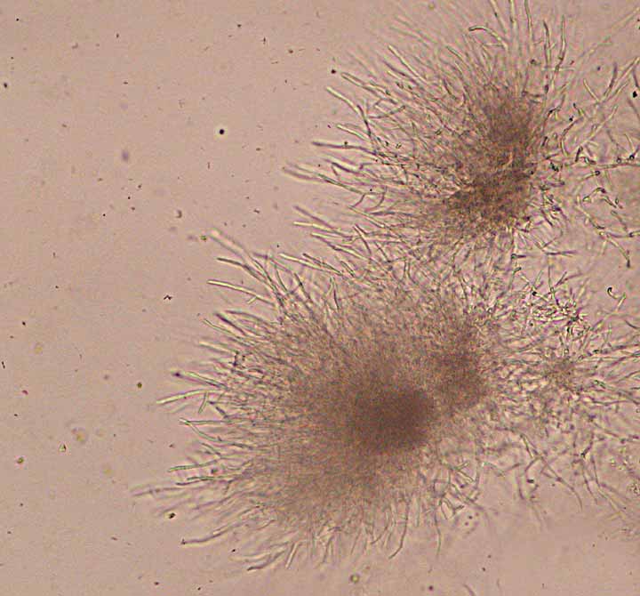 Candida Parapsilosis Morphology On Cornmeal Agar Medical Laboratories Candida Parapsilosis Morphology On Cornmeal Agar Medical Laboratories