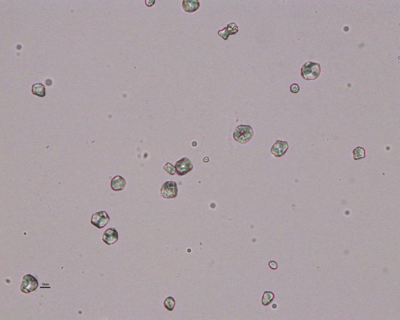 Starch crystals