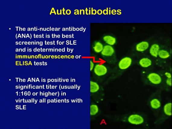 ANA | Anti-Nuclear-Antibody