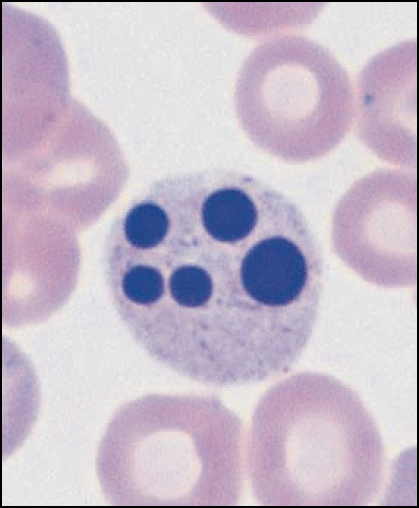 Granulocyte during degradation