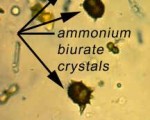 Ammonium biurate crystals
