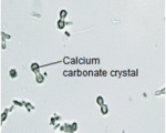 Calcium carbonate crystals