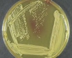 Staphylococcus aureus on mannitol agar