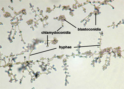 Candida albicans and its pathogenesis, candidiasis bucal en el bebe ...