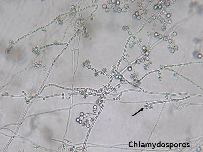 Chlamydospores