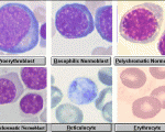 stages of erythropoiesis
